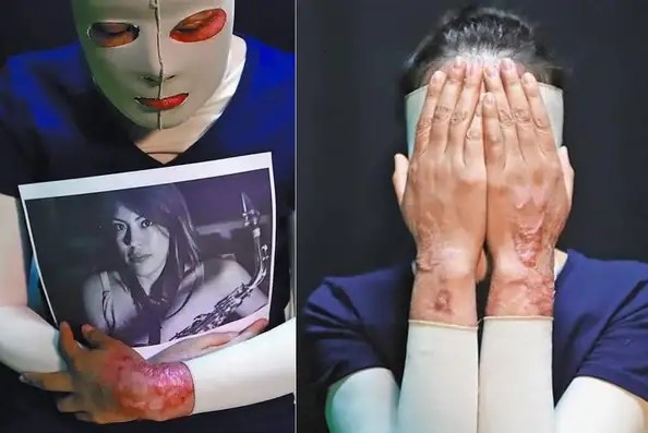 “Aún no consigo mirarme al espejo”: desgarrador relato de una víctima de violencia machista en México